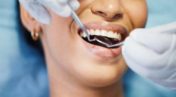 Best Broken or Cracked Tooth Emergency Dentist in USA