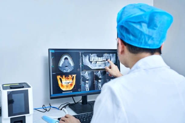 Best Emergency Dentist for Lost Fillings or Crowns in USA